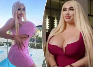 my-333k-plastic-surgery-nightmare-surviving-bbl-complications