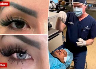 permanent-eye-color-change-procedure-doctor-charges-6k-per-eye