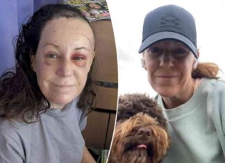 teachers-brain-tumor-diagnosis-linked-to-reading-difficulties