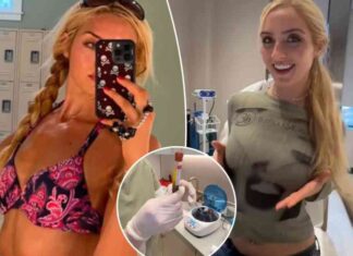 nycs-popular-cleavage-clinic-draws-women-seeking-non-surgical-enhancements