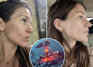 virus-skincare-clears-acne-by-nfecting-bacteria