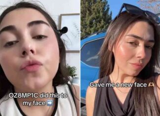 how-to-prevent-sagging-skin-from-ozempic-users-experience-and-tips