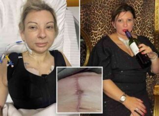 life-changing-mommy-makeover-in-turkey-my-9k-transformation