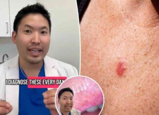 signs-on-your-skin-overlooked-by-dermatologists-what-to-look-for